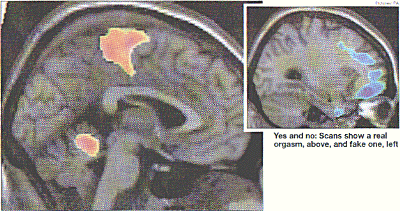 Yes and no:Scans show a real orgasm,inset and a fake one,main picture